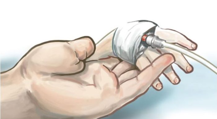 ¿Es moral la eutanasia de bebés incurables…?